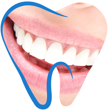dientes-blancos-perladent