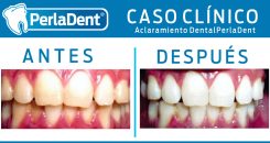 Aclaramiento Dental (8)